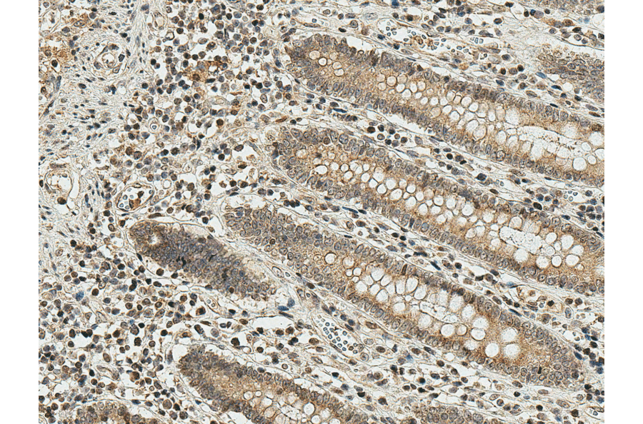 Immunohistochemistry - Anti-Smad3 Antibody (A304887) - Antibodies.com