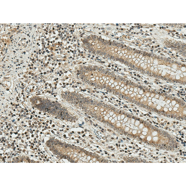 Immunohistochemistry - Anti-Smad3 Antibody (A304887) - Antibodies.com
