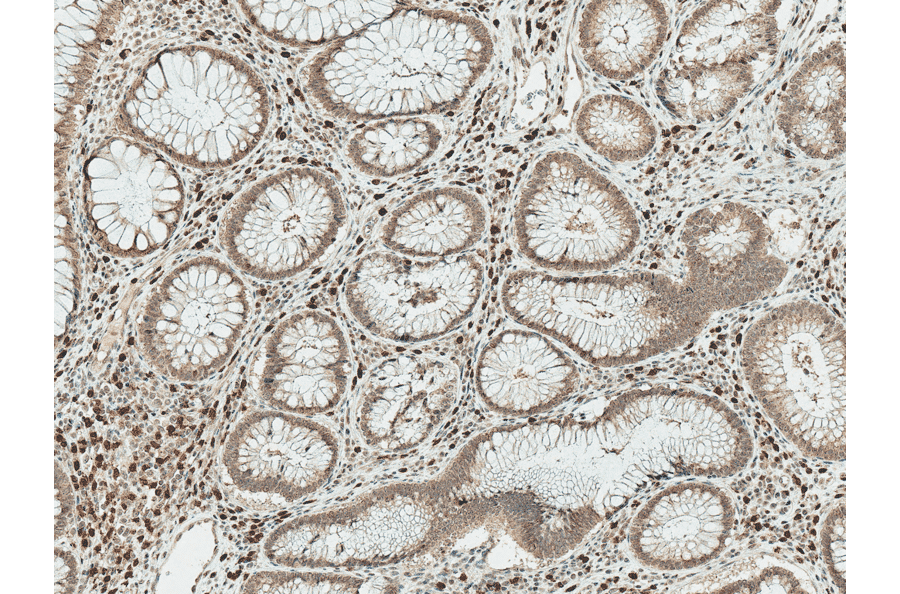 Immunohistochemistry - Anti-Smad3 Antibody (A304888) - Antibodies.com