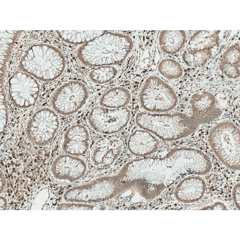 Immunohistochemistry - Anti-Smad3 Antibody (A304888) - Antibodies.com