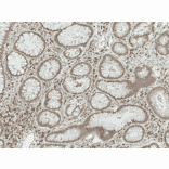 Immunohistochemistry - Anti-Smad3 Antibody (A304888) - Antibodies.com