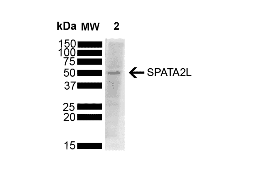 Western Blot - Anti-SPATA2L Antibody [Z2 P2D5-C8] (A304889) - Antibodies.com