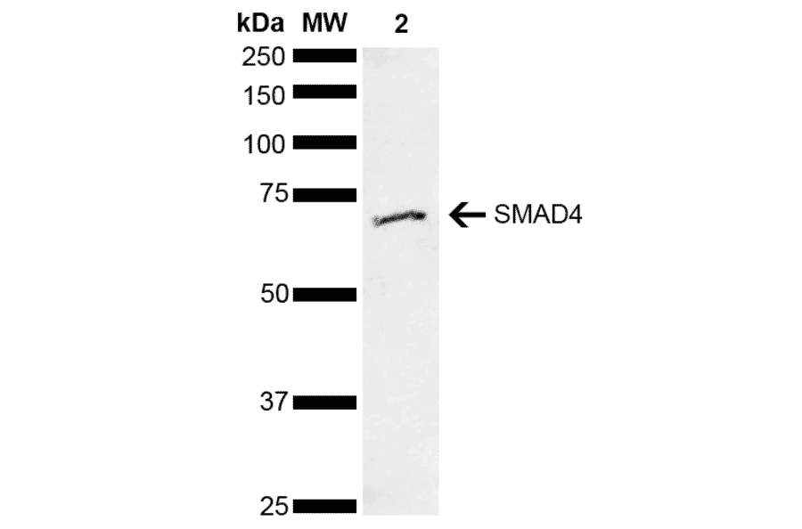 Western Blot - Anti-Smad4 Antibody (A304891) - Antibodies.com