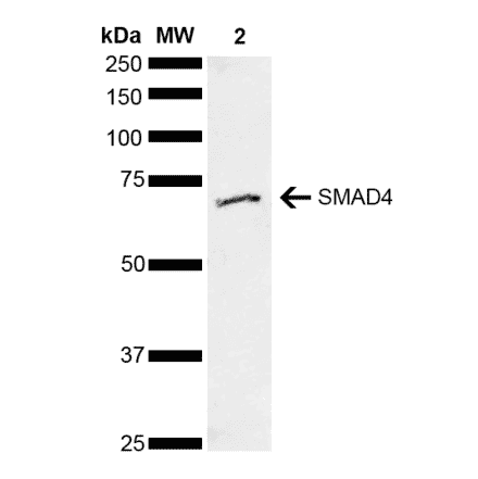 Western Blot - Anti-Smad4 Antibody (A304891) - Antibodies.com
