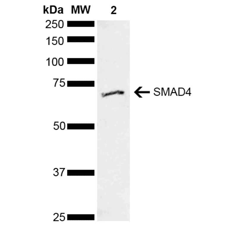 Western Blot - Anti-Smad4 Antibody (A304891) - Antibodies.com