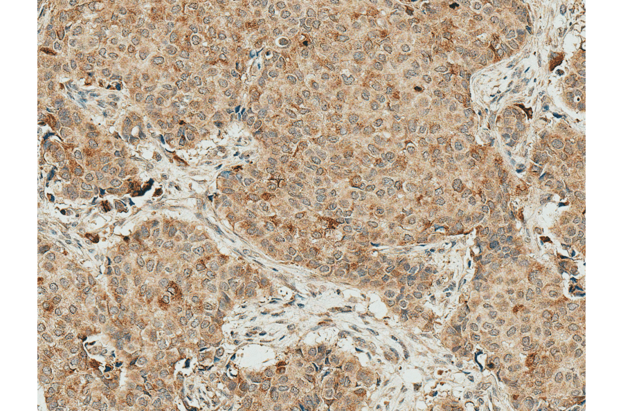Immunohistochemistry - Anti-Smad4 Antibody (A304891) - Antibodies.com