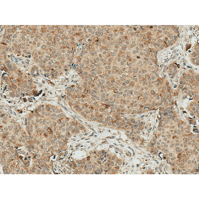 Immunohistochemistry - Anti-Smad4 Antibody (A304891) - Antibodies.com