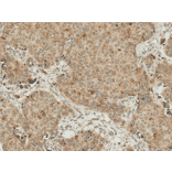 Immunohistochemistry - Anti-Smad4 Antibody (A304891) - Antibodies.com