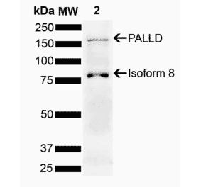 Western Blot - Anti-Palladin Antibody (A304894) - Antibodies.com