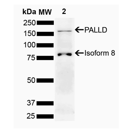 Western Blot - Anti-Palladin Antibody (A304894) - Antibodies.com