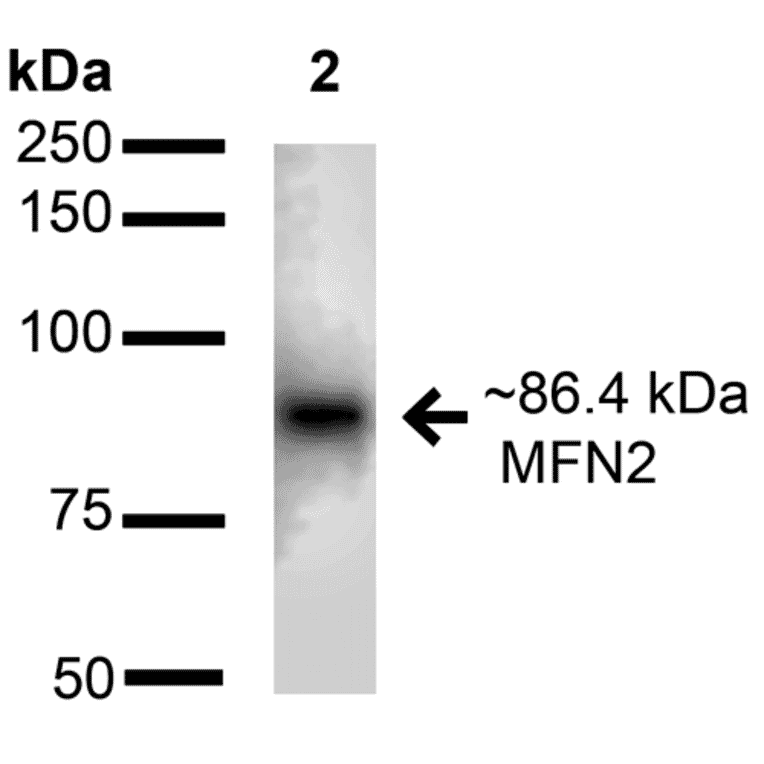 Western Blot - Anti-Mitofusin 2 Antibody (A304895) - Antibodies.com