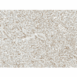 Immunohistochemistry - Anti-Mitofusin 2 Antibody (A304895) - Antibodies.com