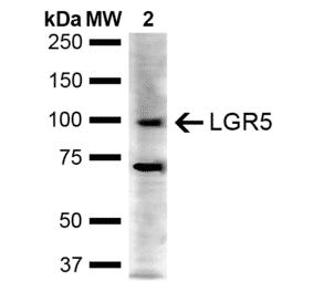 Western Blot - Anti-LGR5 Antibody (A304897) - Antibodies.com