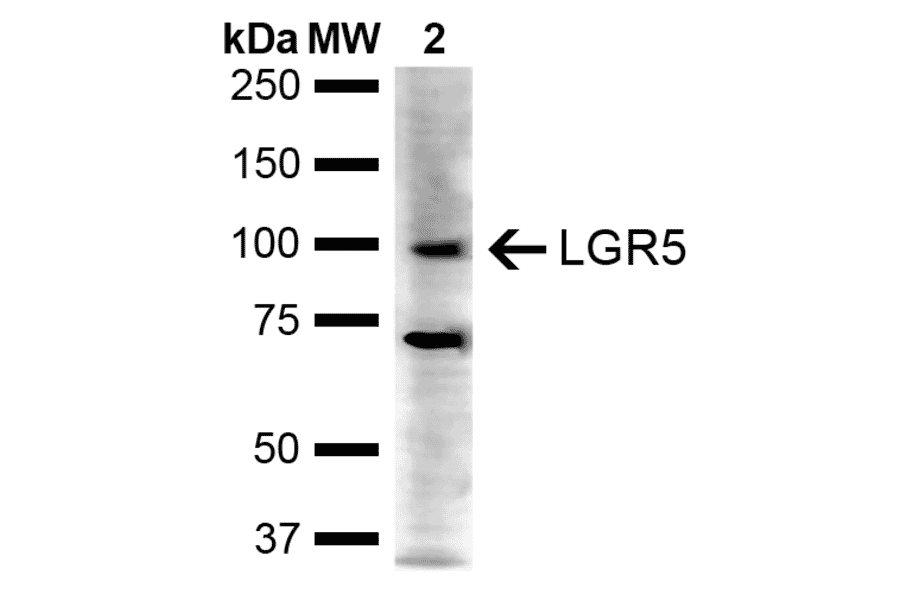 Western Blot - Anti-LGR5 Antibody (A304897) - Antibodies.com