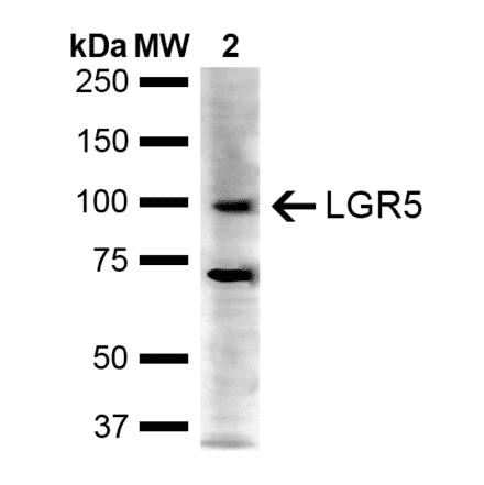 Western Blot - Anti-LGR5 Antibody (A304897) - Antibodies.com