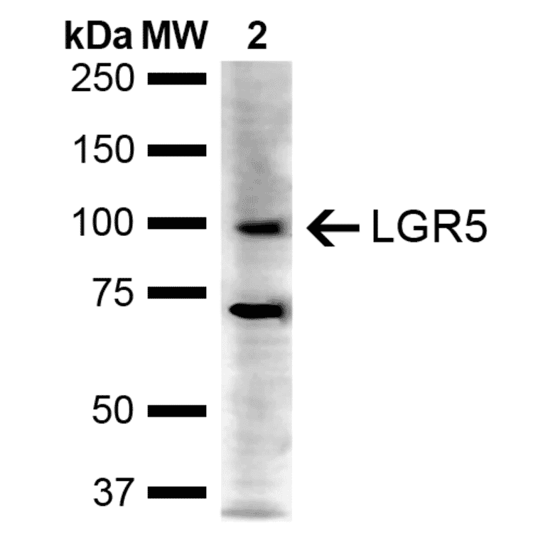 Western Blot - Anti-LGR5 Antibody (A304897) - Antibodies.com