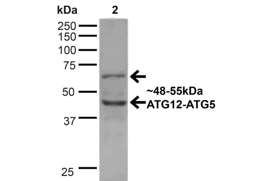 Western Blot - Anti-ATG12 Antibody (A304899) - Antibodies.com