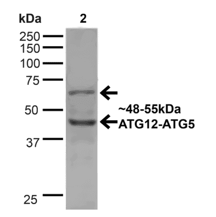 Western Blot - Anti-ATG12 Antibody (A304899) - Antibodies.com