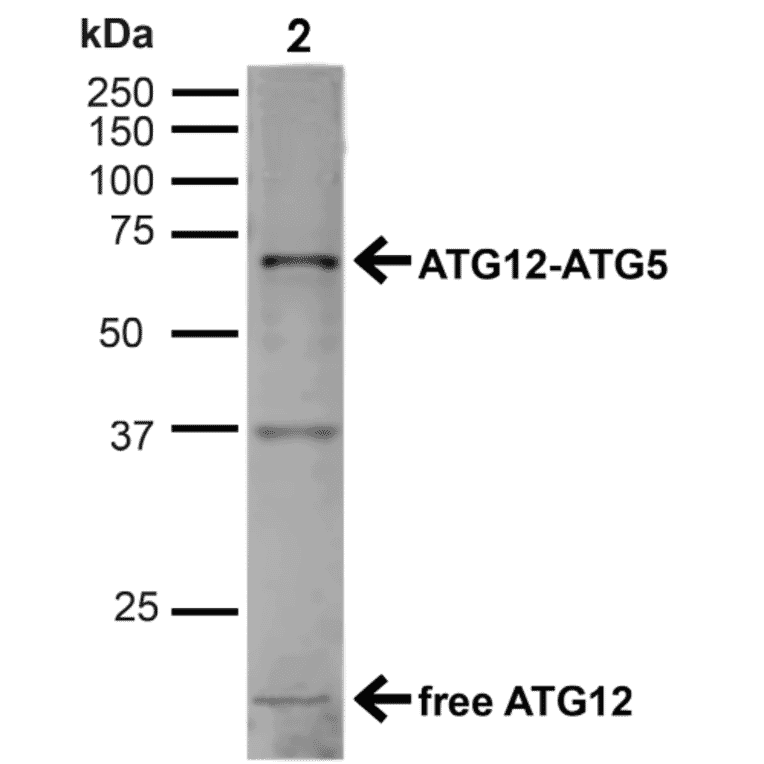 Western Blot - Anti-ATG12 Antibody (A304900) - Antibodies.com