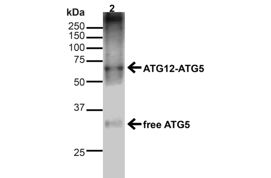 Western Blot - Anti-ATG5 Antibody (A304901) - Antibodies.com