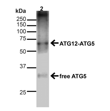 Western Blot - Anti-ATG5 Antibody (A304901) - Antibodies.com