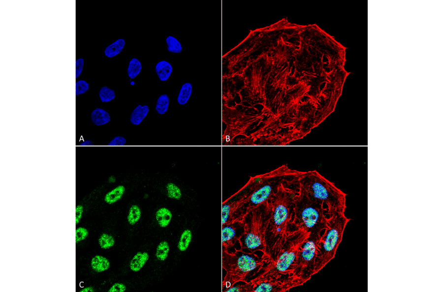 Immunocytochemistry/Immunofluorescence - Anti-ATG5 Antibody (A304901) - Antibodies.com