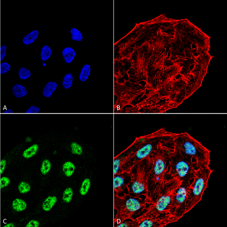 Immunocytochemistry/Immunofluorescence - Anti-ATG5 Antibody (A304901) - Antibodies.com