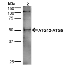 Western Blot - Anti-ATG5 Antibody (A304902) - Antibodies.com