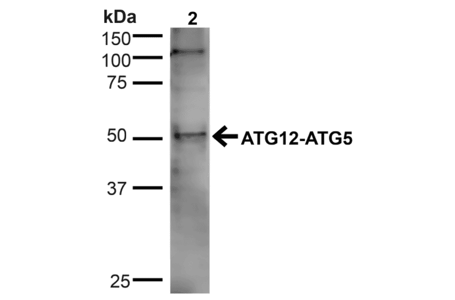 Western Blot - Anti-ATG5 Antibody (A304902) - Antibodies.com