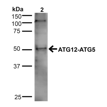 Western Blot - Anti-ATG5 Antibody (A304902) - Antibodies.com