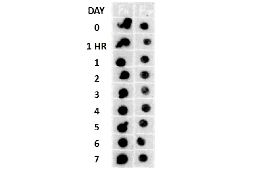 Dot Blot - Anti-Amyloid Fibrils Antibody (A304905) - Antibodies.com