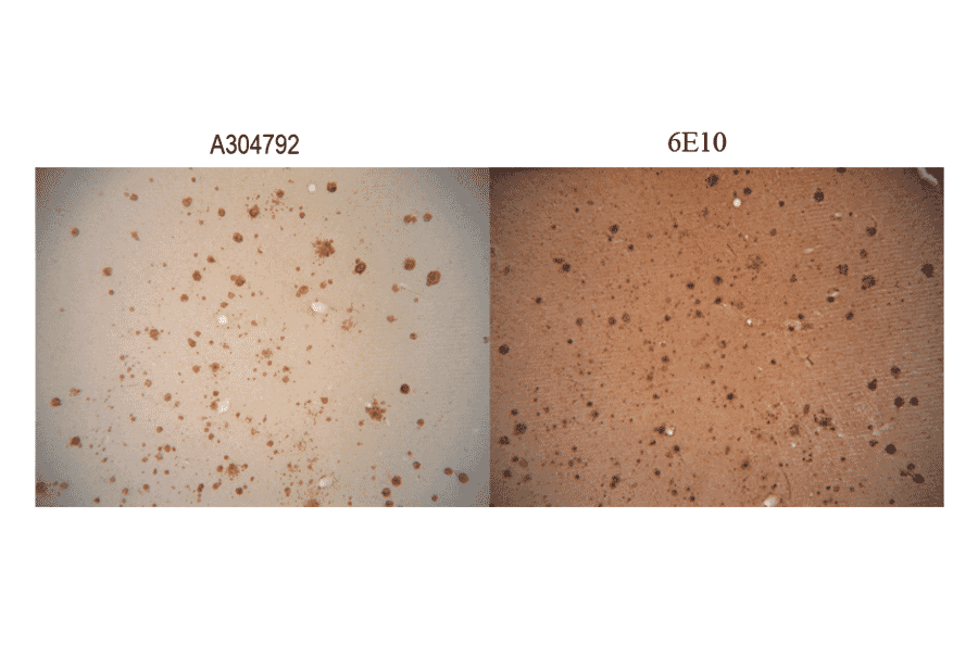 Immunohistochemistry - Anti-Amyloid Fibrils Antibody (A304905) - Antibodies.com