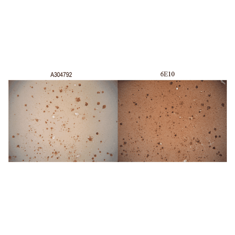 Immunohistochemistry - Anti-Amyloid Fibrils Antibody (A304905) - Antibodies.com