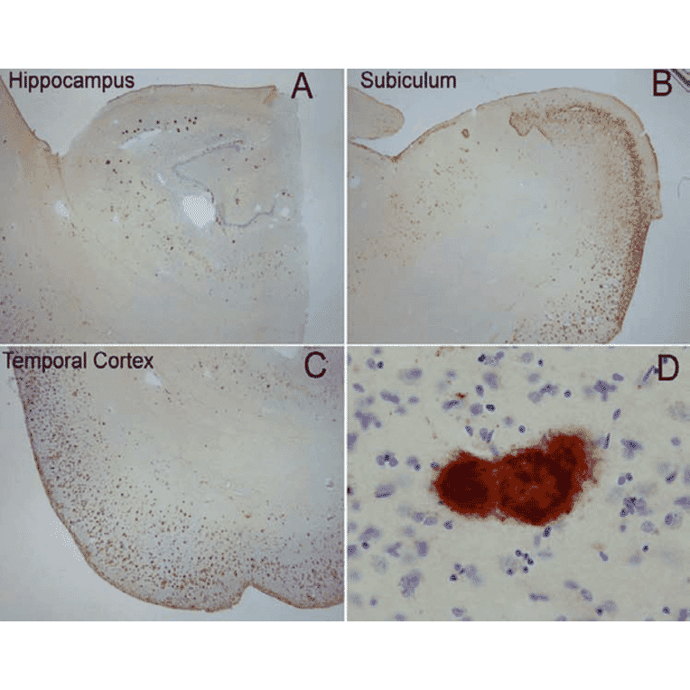Immunohistochemistry - Anti-Amyloid Fibrils Antibody (A304905) - Antibodies.com