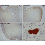 Immunohistochemistry - Anti-Amyloid Fibrils Antibody (A304905) - Antibodies.com