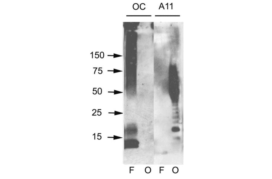Western Blot - Anti-Amyloid Fibrils Antibody (A304905) - Antibodies.com