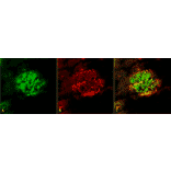 Immunohistochemistry - Anti-Amyloid Fibrils Antibody (A304905) - Antibodies.com