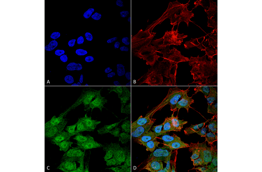 Immunocytochemistry/Immunofluorescence - Anti-ATG9B Antibody (A304906) - Antibodies.com