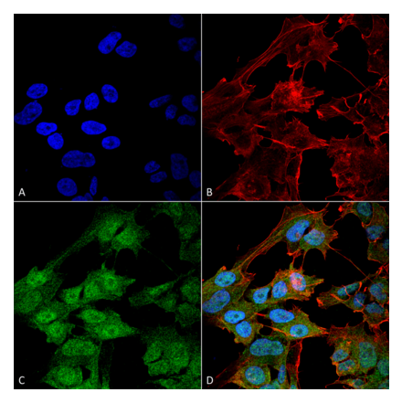 Immunocytochemistry/Immunofluorescence - Anti-ATG9B Antibody (A304906) - Antibodies.com