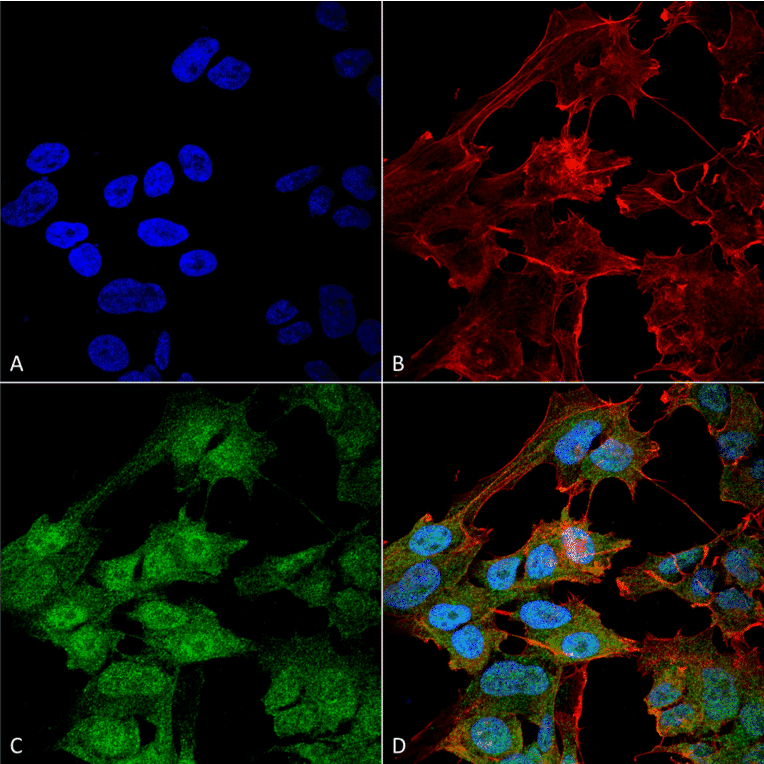 Immunocytochemistry/Immunofluorescence - Anti-ATG9B Antibody (A304906) - Antibodies.com