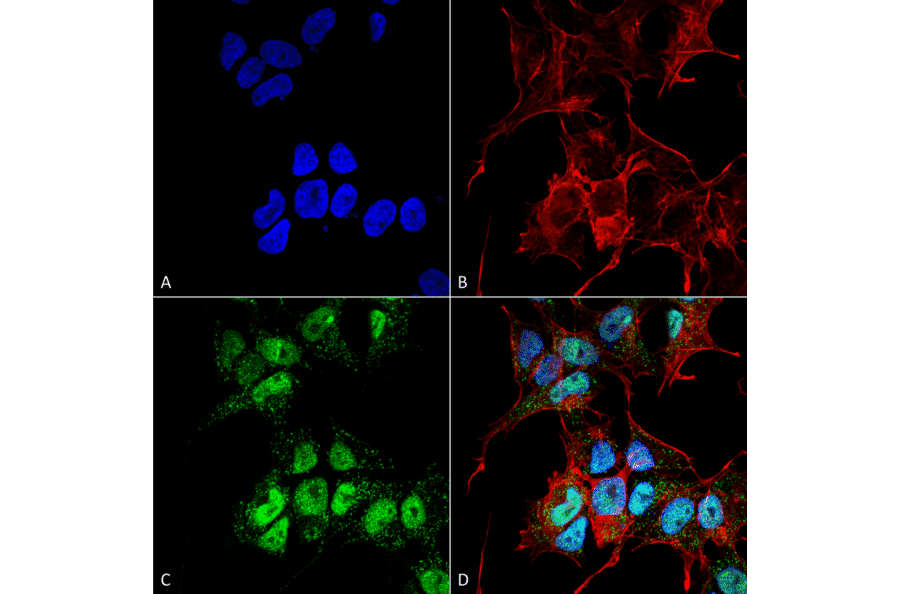 Immunocytochemistry/Immunofluorescence - Anti-GABARAPL1 Antibody (A304907) - Antibodies.com