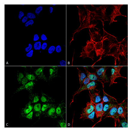 Immunocytochemistry/Immunofluorescence - Anti-GABARAPL1 Antibody (A304907) - Antibodies.com