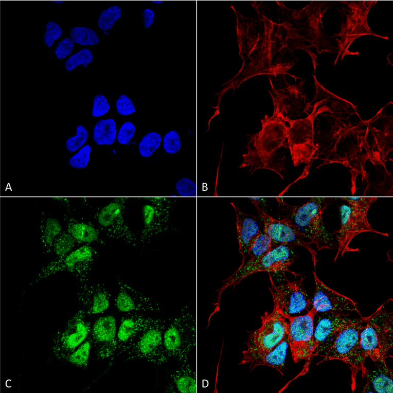 Immunocytochemistry/Immunofluorescence - Anti-GABARAPL1 Antibody (A304907) - Antibodies.com