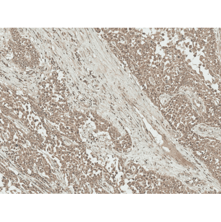 Immunohistochemistry - Anti-IGF1 Antibody (A304908) - Antibodies.com