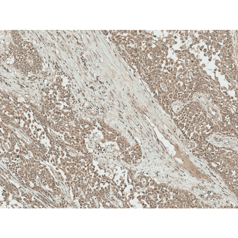 Immunohistochemistry - Anti-IGF1 Antibody (A304908) - Antibodies.com