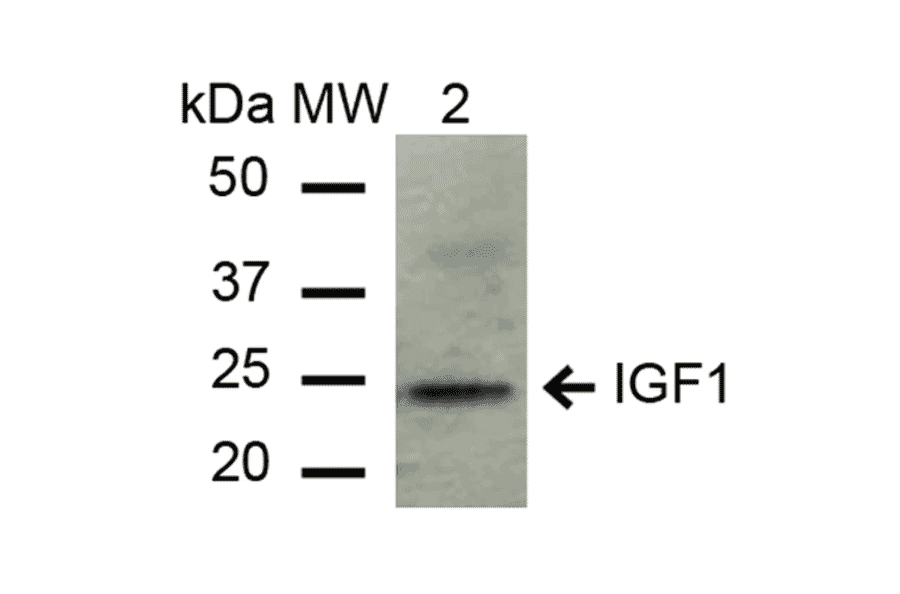 Western Blot - Anti-IGF1 Antibody (A304908) - Antibodies.com