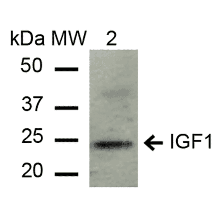 Western Blot - Anti-IGF1 Antibody (A304908) - Antibodies.com