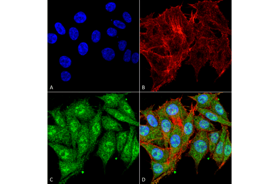 Immunocytochemistry/Immunofluorescence - Anti-IGF1 Antibody (A304908) - Antibodies.com