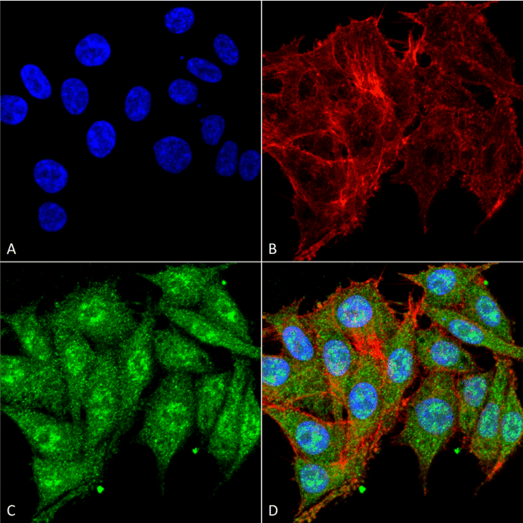Immunocytochemistry/Immunofluorescence - Anti-IGF1 Antibody (A304908) - Antibodies.com
