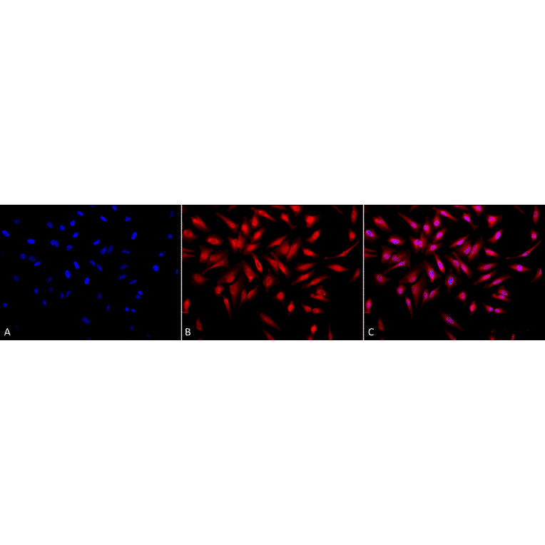 Immunocytochemistry/Immunofluorescence - Anti-ING1 Antibody (A304909) - Antibodies.com